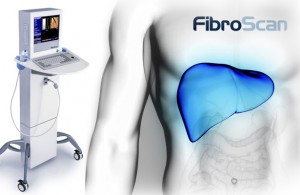 fibroscan